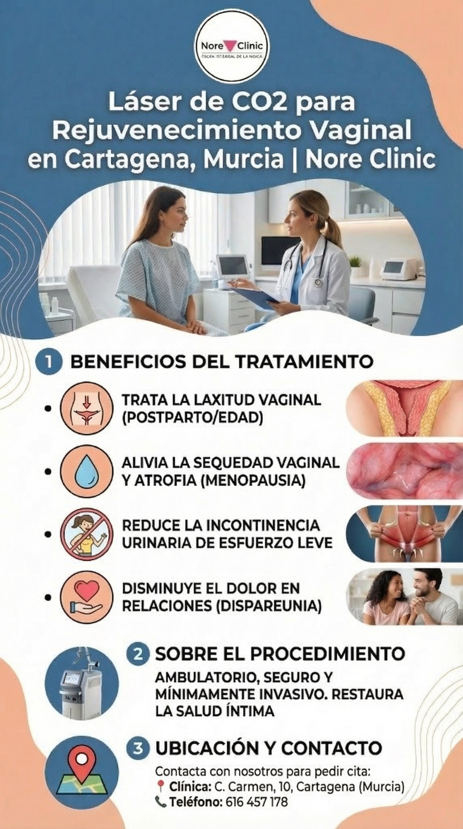 Láser de CO2 para Rejuvenecimiento Vaginal en Cartagena | Nore Clinic